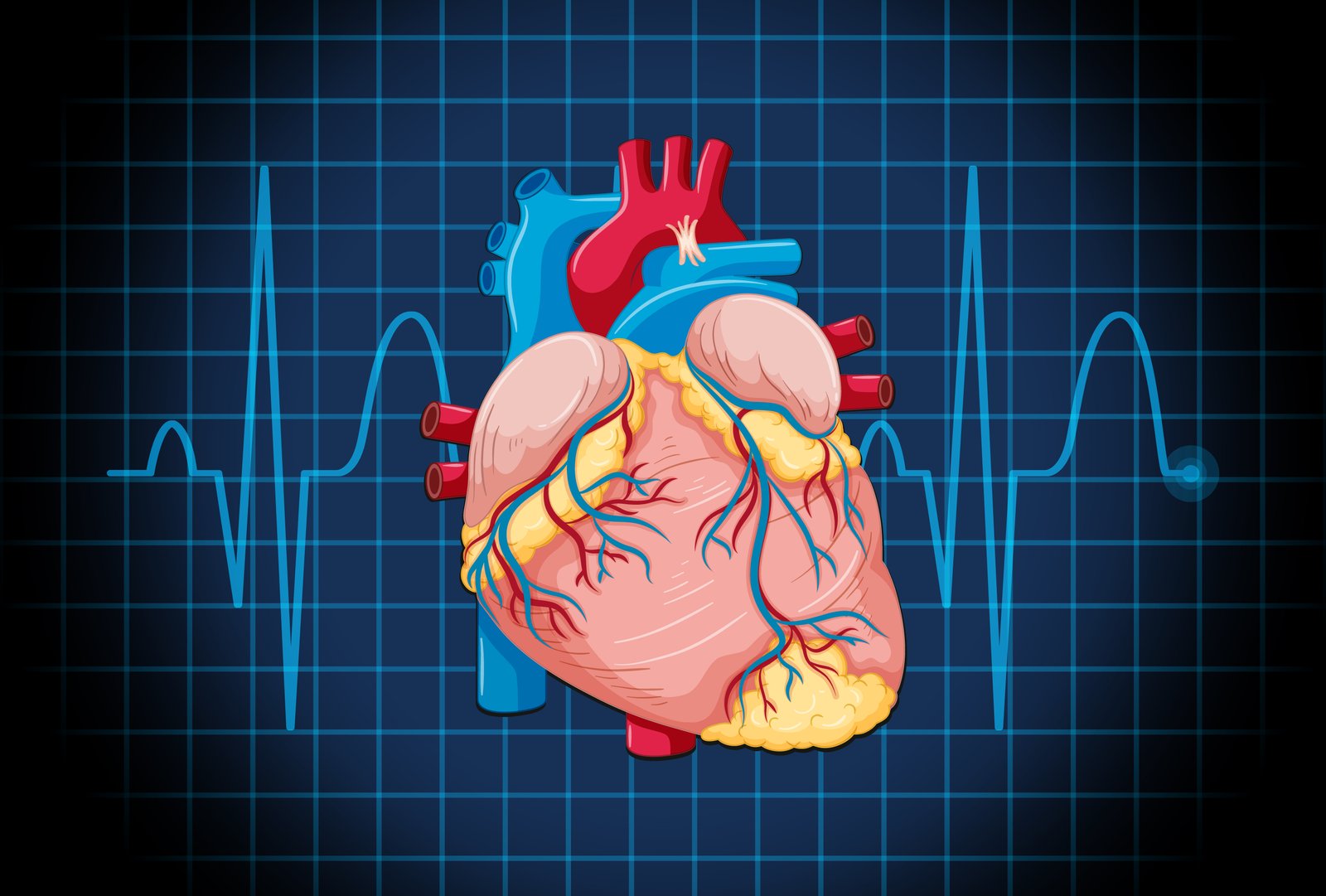 ECHO (Echocardiography)